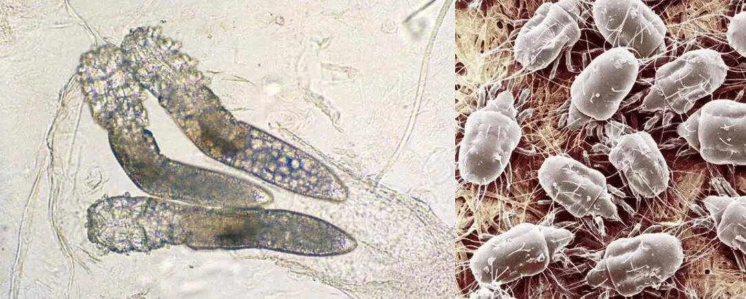 皮肤粗糙瘙痒长痘痘?小心螨虫正在你的毛孔里大量繁殖