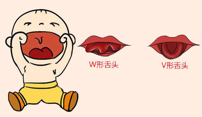你家宝宝是这样吐舌头吗?妈妈要当心了