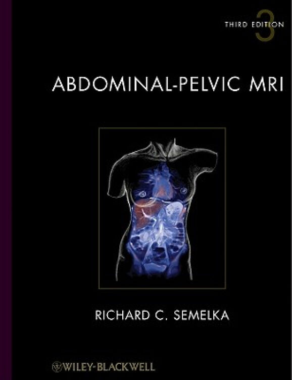 【预订】abdominal-pelvic mri, thir