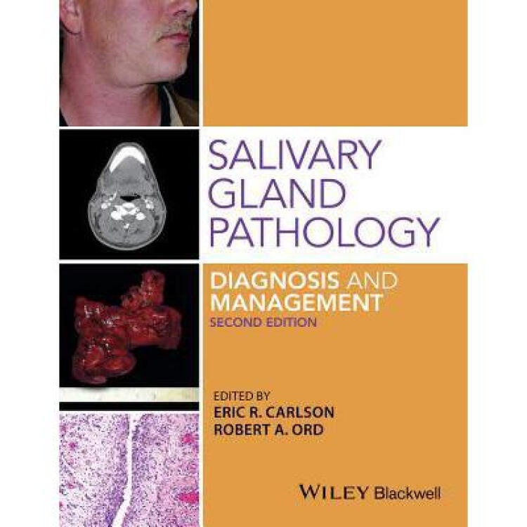salivary gland pathology: diagnosis and .