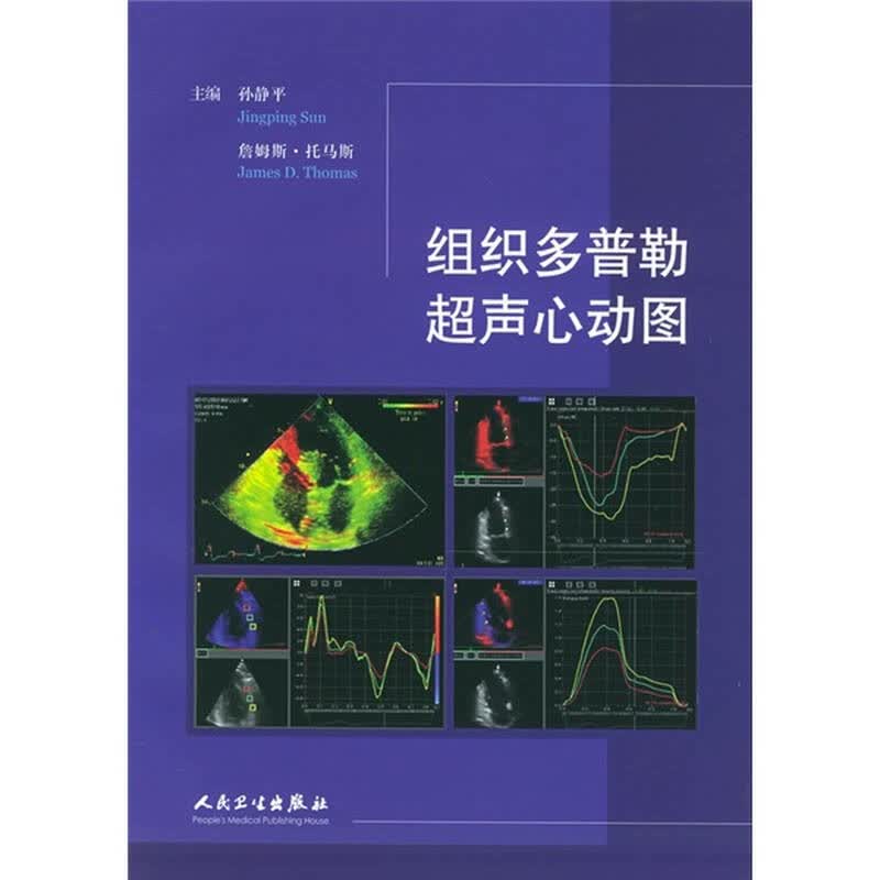 组织多普勒超声心动图【图片 价格 品牌 报价】-京东