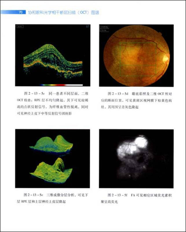 协和眼科光学相干断层扫描(oct)图谱