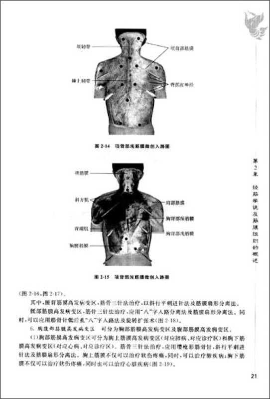 筋骨三针疗法