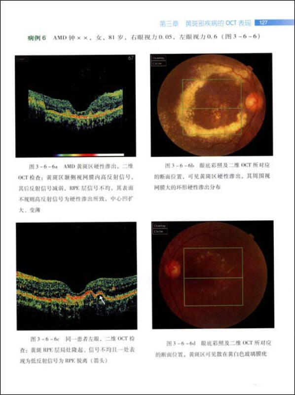 协和眼科光学相干断层扫描(oct)图谱