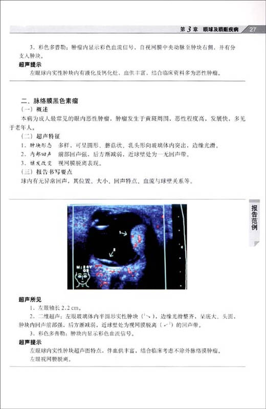 超声报告书写示例