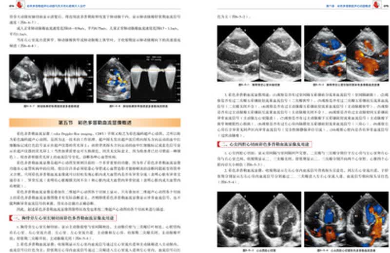 彩色多普勒超声心动图与先天性心脏病介入治疗