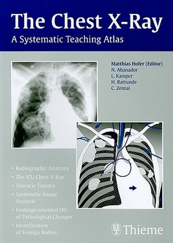 buried chest,buriedtreasure 【预订】the chest x-ray: a systematic teaching