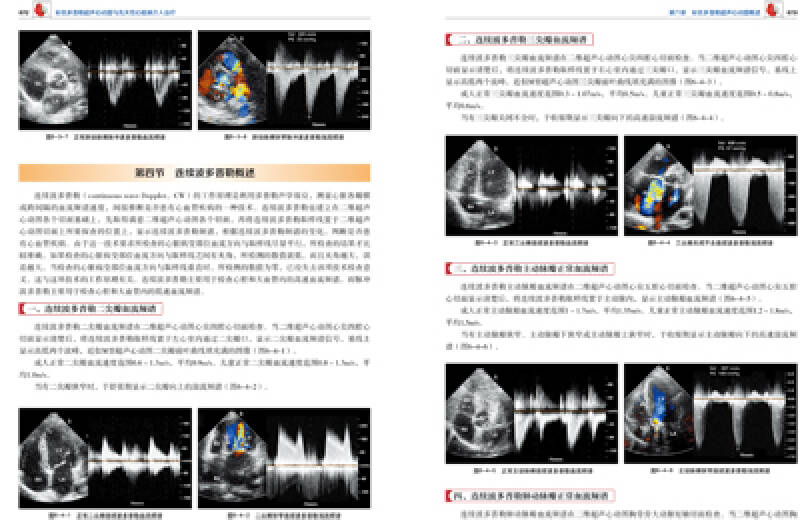 彩色多普勒超声心动图与先天性心脏病介入治疗