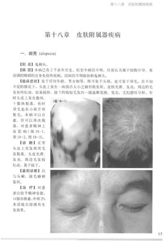 常见皮肤病诊断彩色图谱