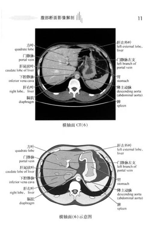 腹部影像解剖图谱 自营