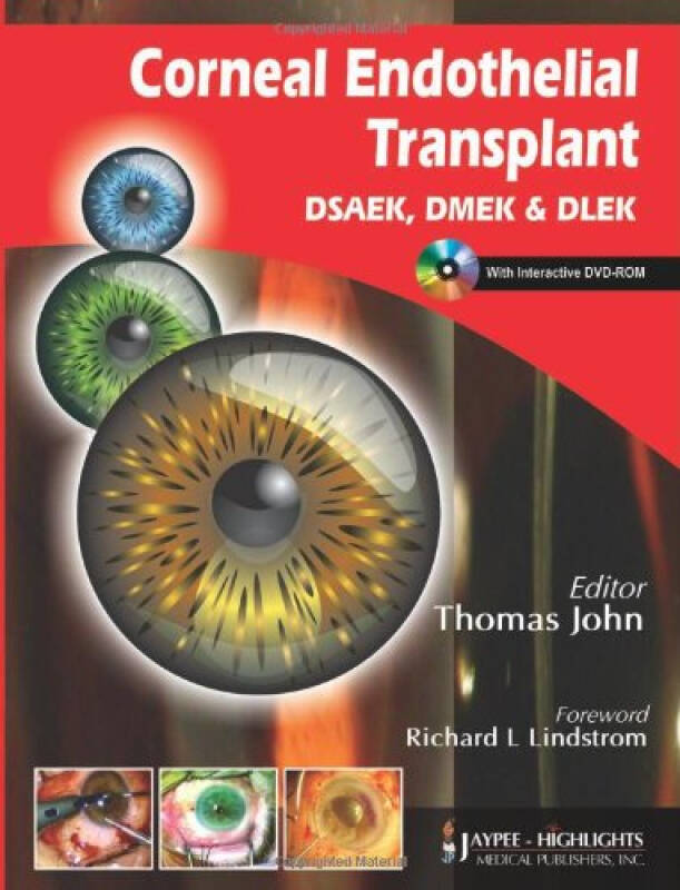 corneal endothelial transplant dsaekdme