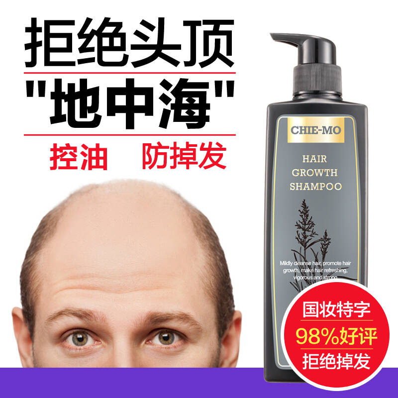 防脱发洗发水防掉洗头水控油强韧清妙(chie-mo)欣姬防