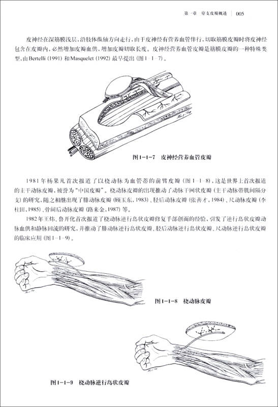 穿支皮瓣手术图解