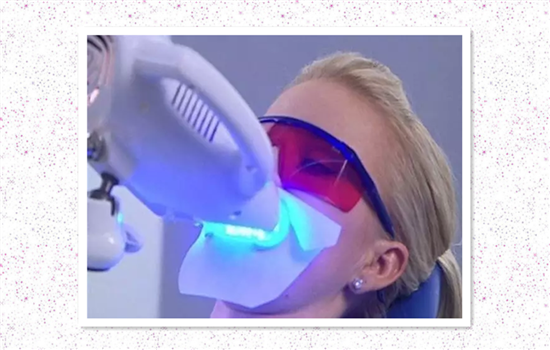 激光牙齿美白能维持多久 正确护理可以让效果持续3-5年