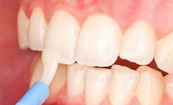 牙齿涂氟有哪些优点?哪些孩子的牙齿要尽快涂氟? - 京东