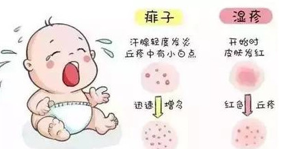 宝宝长痱子怎么办?用花露水和爽身粉有效吗?