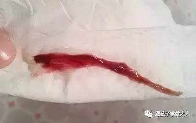 女人有这感觉就是受精卵着床!你马上要当妈了!