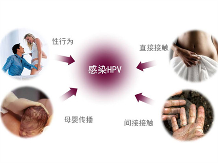 hpv感染是怎么引起的hpv感染是什么引起的_hpv感染途径
