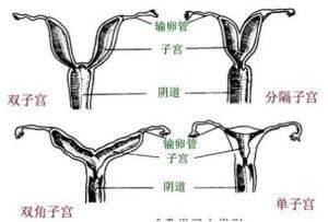 子宫畸形会不会影响怀孕?