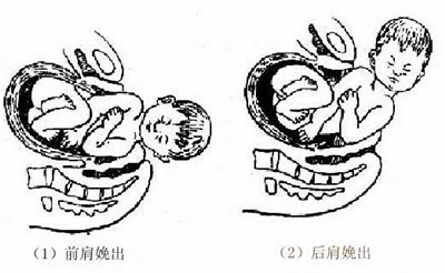 分娩机制的过程_什么是分娩机制_分娩