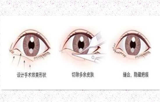 下眼睑 京东