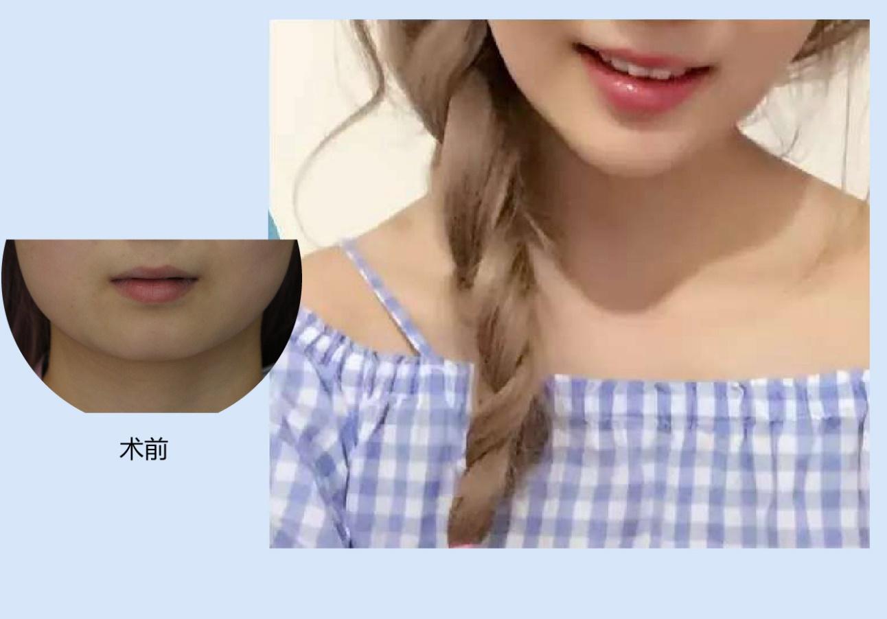完美人生 完美人生