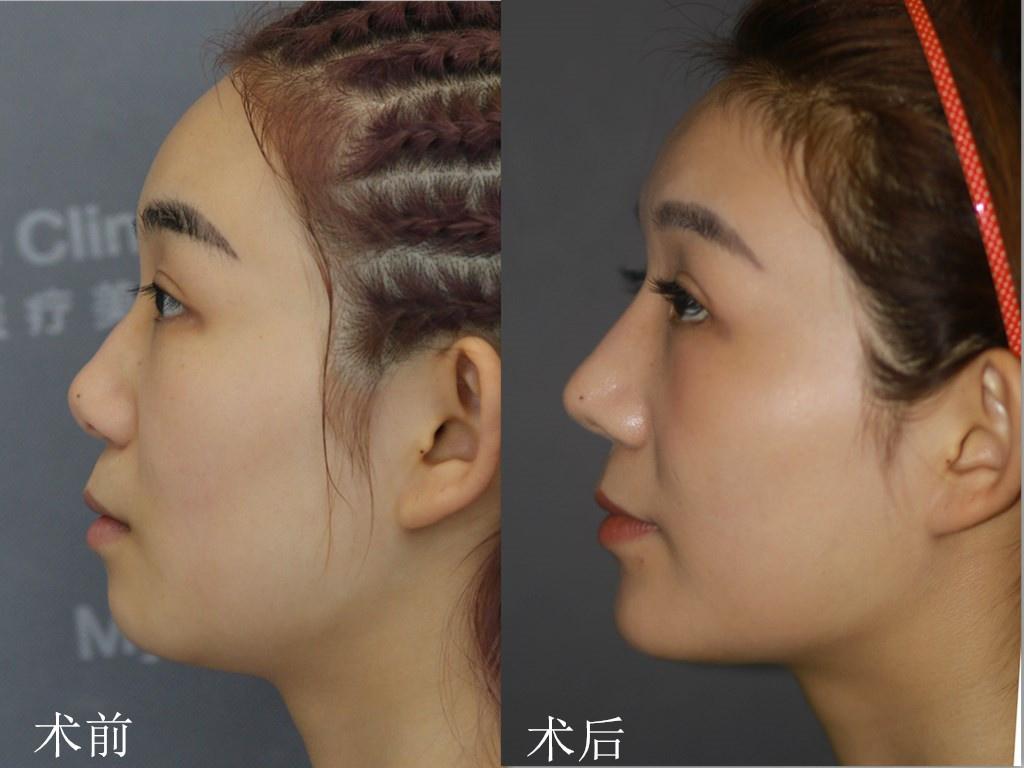 完美人生 完美人生