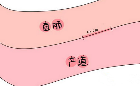 顺产时胎儿突然从肛门出来,产科医生这个动作简直太机智了