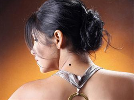 脖子后面有痣代表什么脖子后面有痣说明什么_脖子后面