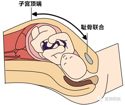 产检必须要懂的:胎心,宫高,腹围