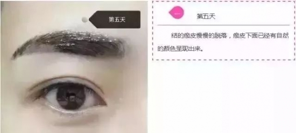 纹眉七天的变化 小仙女快看过来吧