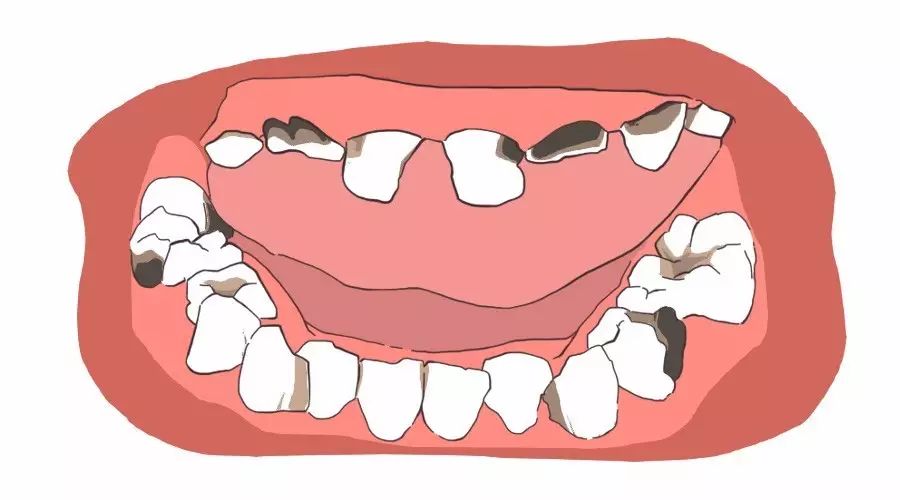 宝宝糖吃得多,不仅仅是危害牙齿!