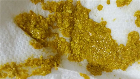 奶瓣宝宝拉屎有奶瓣_宝宝拉屎有奶瓣是怎么回事- 京东