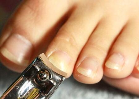 大母脚趾甲有横纹图片