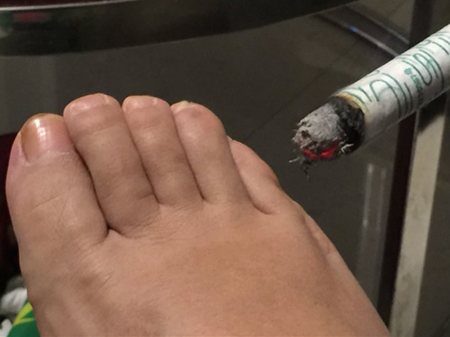 胎位不正艾灸的时间艾灸胎位不正最佳时间_胎位不正艾灸几点合适