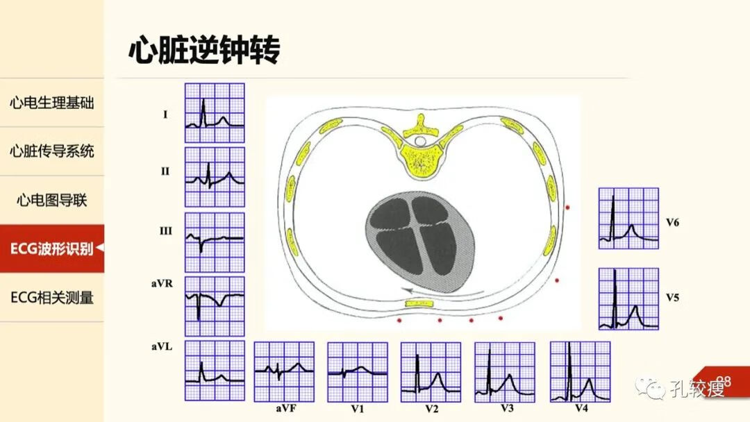 心电图导联位置示意图(心电图机导联位置图)