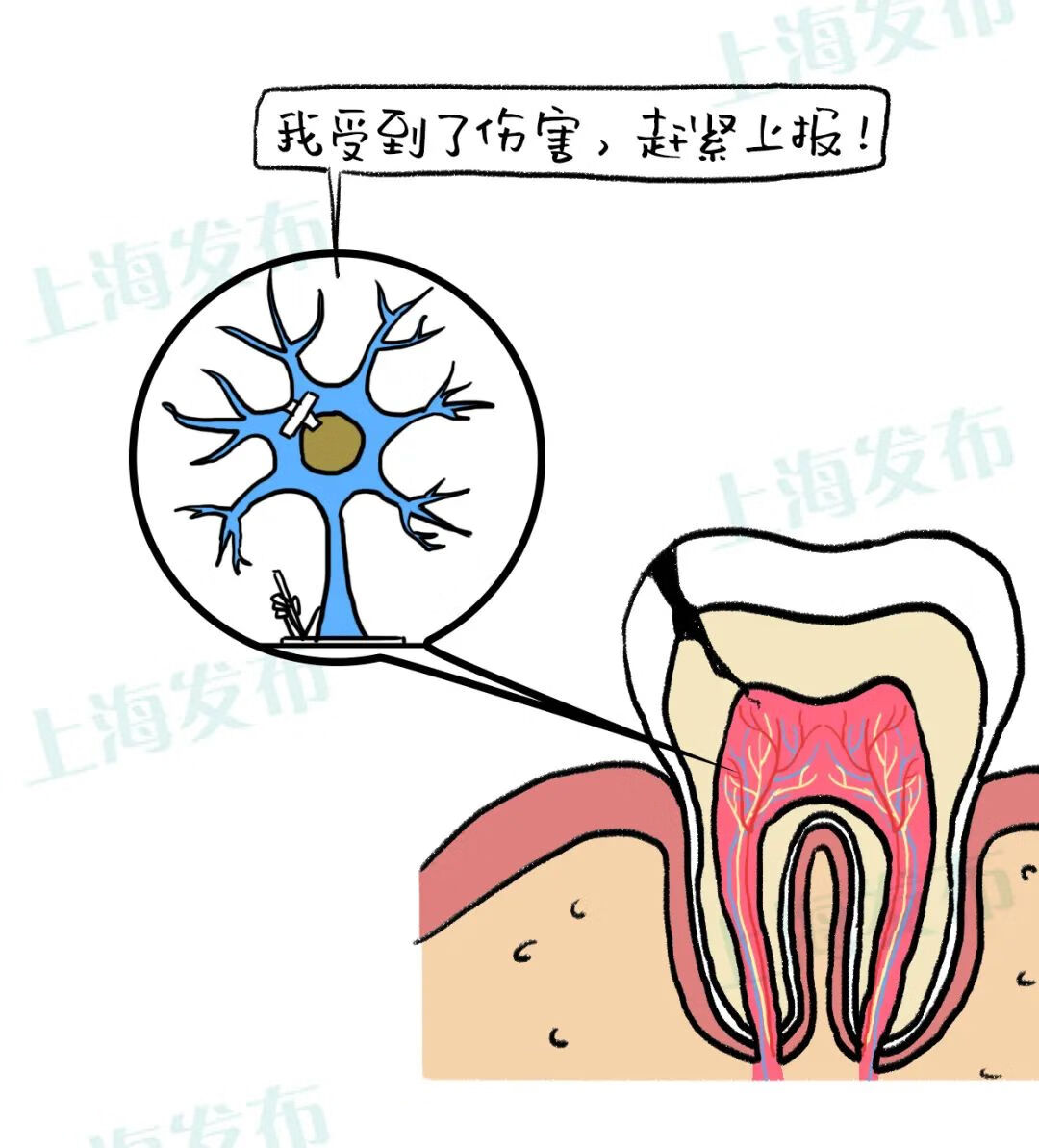 牙神经痛怎么解决(牙痛到神经痛怎么办)