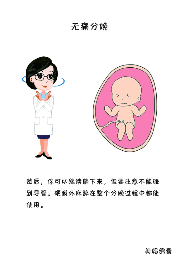 什么是无痛分娩啊(什么是女性的无痛分娩)