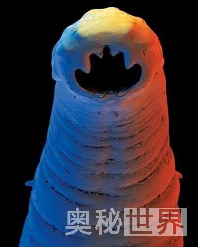 人体寄生虫有哪些(人体寄生虫图片)