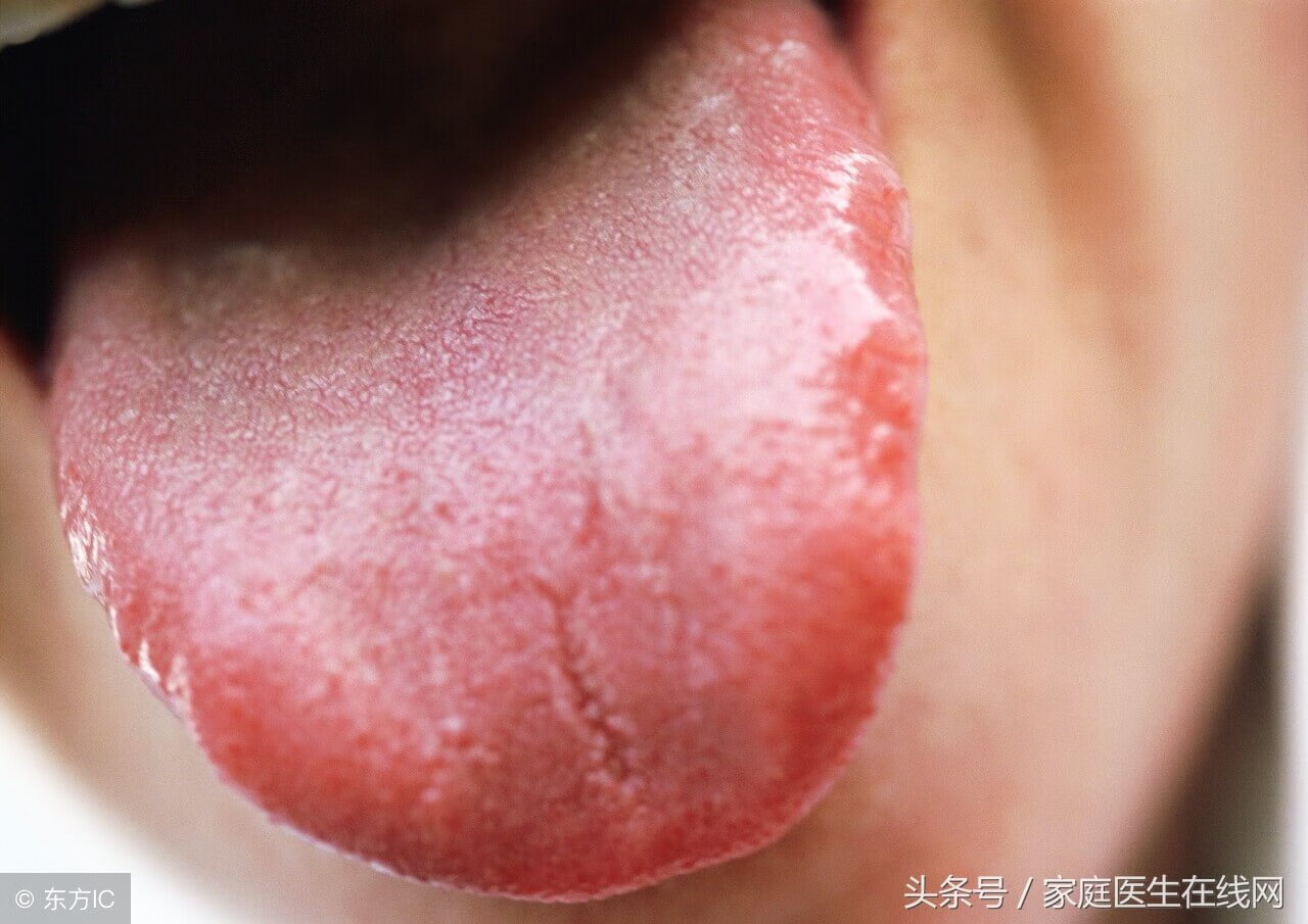 身体湿气重的表现?(身体内湿气重有哪些表现)