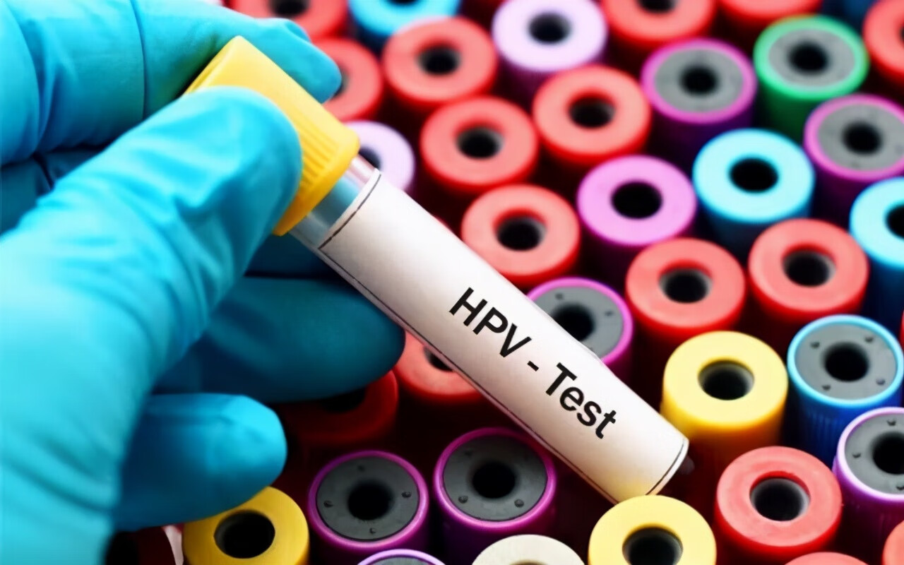 hpv病毒感染是什么病(hpv病毒发现)