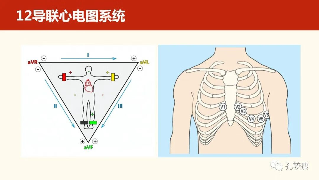 心电图导联位置示意图(心电图机导联位置图)