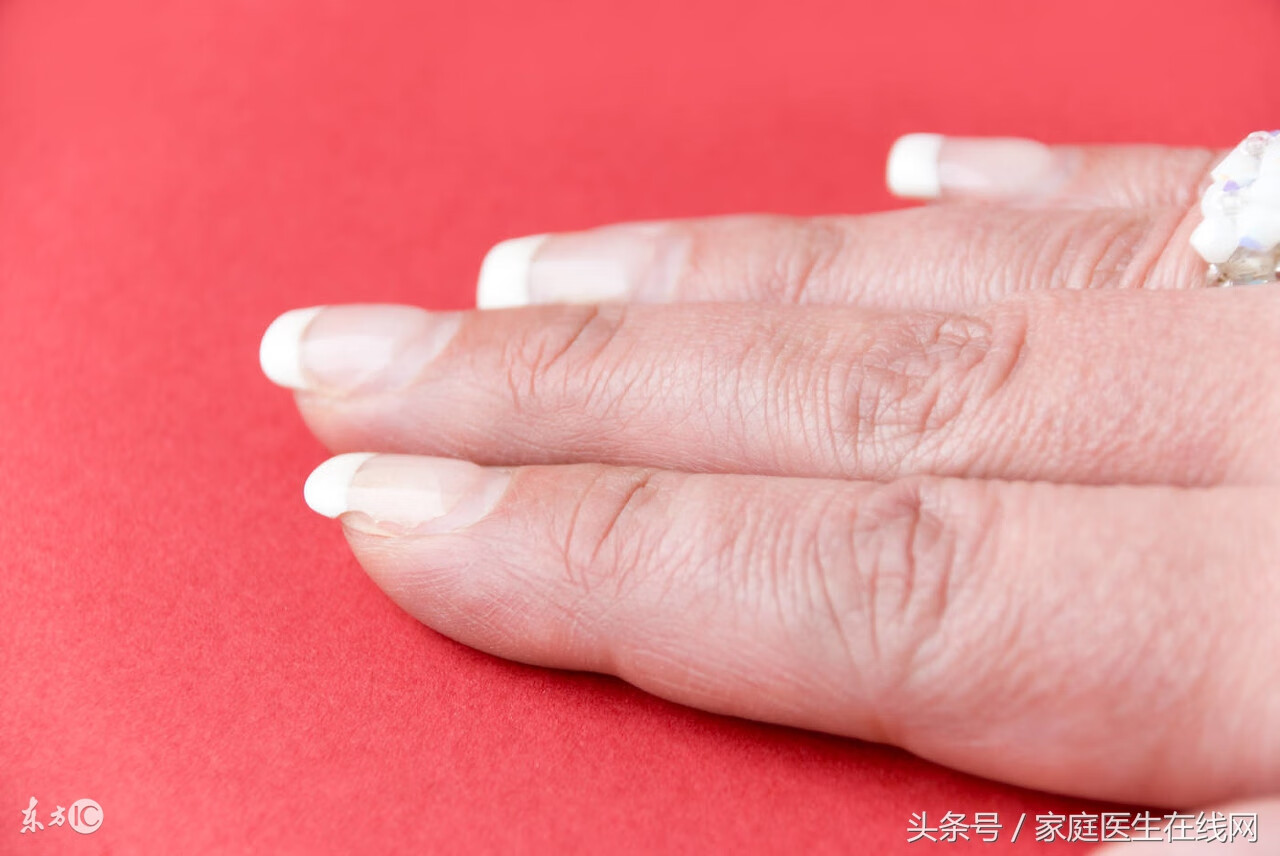 手指甲没有月牙代表什么(指甲上几乎没有月牙)