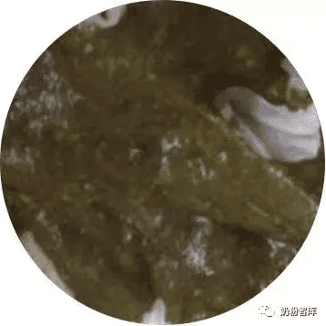 三个月宝宝大便绿色条状(3个月宝宝拉绿色大便)