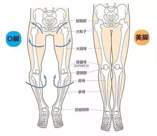 罗圈腿矫正带有效果吗(罗圈腿用绑带矫正可以吗)
