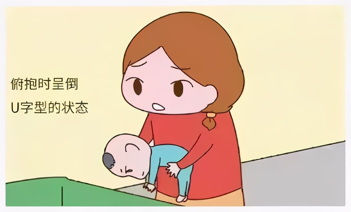 发烧脑瘫儿的症状(脑瘫是什么表现症状)