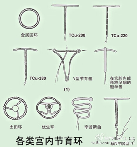 节育环图片 种类(节育环的种类名称和图片)