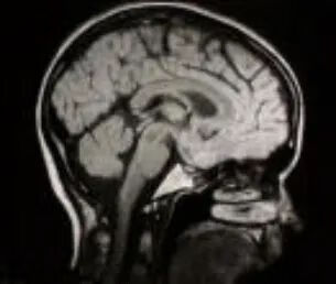 反推数学模型(计算反推)