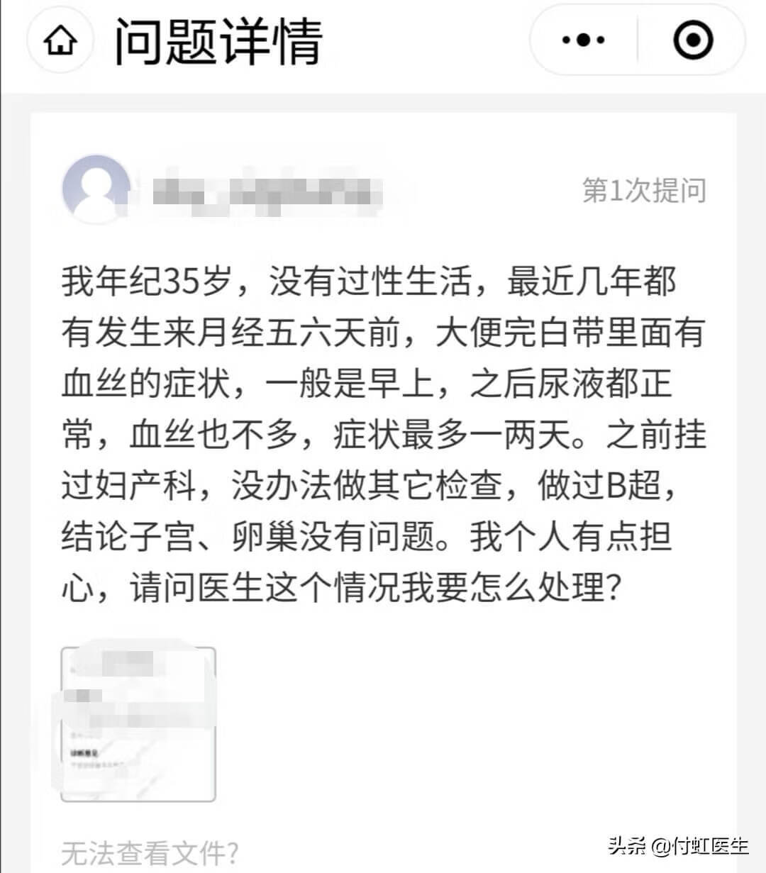 快要来月经前出血(月经前出血是怎么回事)