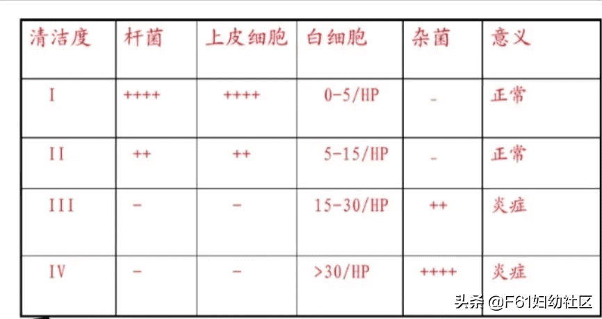 白带常规检查(白带常规能检查出什么)